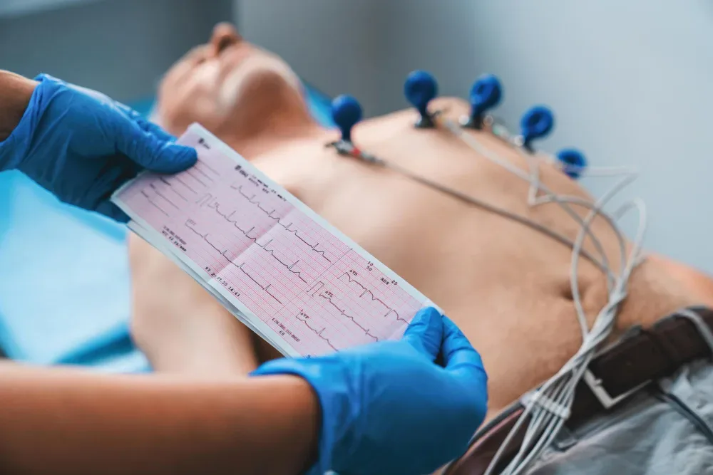 Electrocardiograma de 12 derivaciones